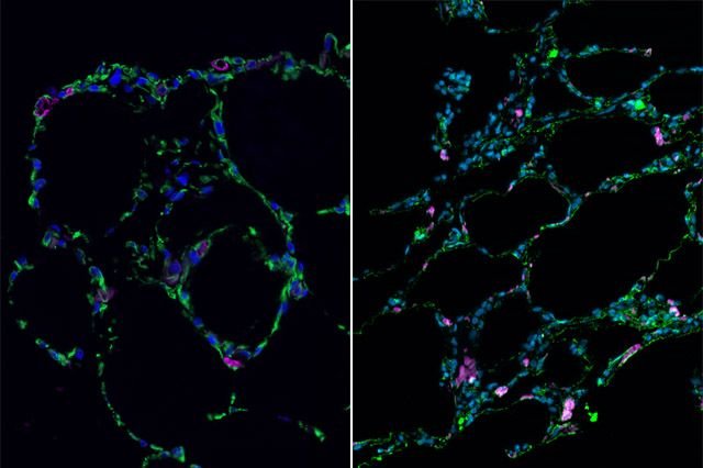 
Mặt cắt ngang của mô phổi dưới kính hiển vi. Ảnh: UCLA Broad Stem Cell Research Center
