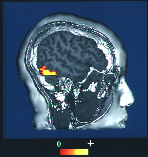  Khu vực FFA trong não bộ con người. 