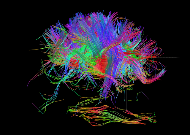 Hình ảnh cho thấy sự phức tạp của các kết nối thần kinh, việc tạo ra một ý thức tổng hợp mô phỏng con người là không đơn giản.