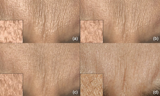 Tấm hình cho thấy cảm xúc khuôn mặt được biểu lộ dưới những hình ảnh về hình dạng da.