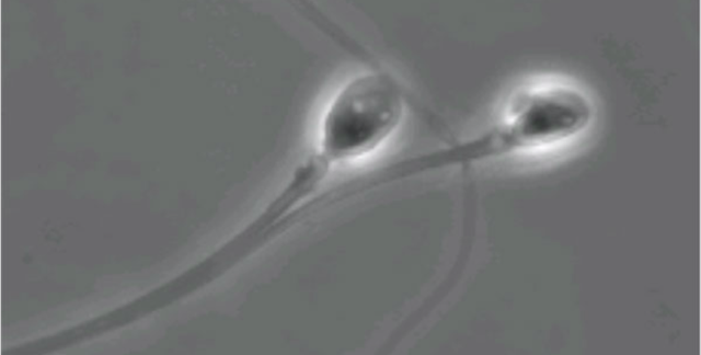  Công nghệ hoá đông tinh trùng hoàn toàn có thể vô hiệu hoá một loại protein trên đuôi của tế bào tinh trùng - làm chúng quá cứng để có thể bơi một cách hiệu quả. 