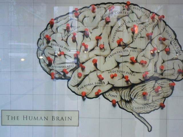 Các tín hiệu từ não người có thể được dịch ngược lại thành văn bản.