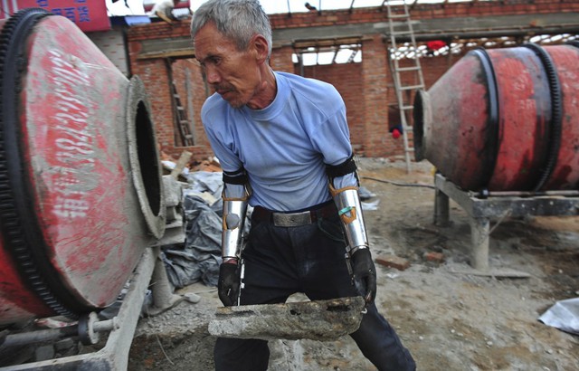  14. Người nông dân Trung Quốc tên Sun Jifa này đã bị mất hai cánh tay trong vụ tai nạn khi dùng chất nổ đánh bắt cá. Không đủ tiền mua tay giả, ông đã bỏ ra 2 năm để hướng dẫn 2 người cháu chế tạo ra cánh tay giả cho mình từ kim loại phế thải, nhựa và cao su. 