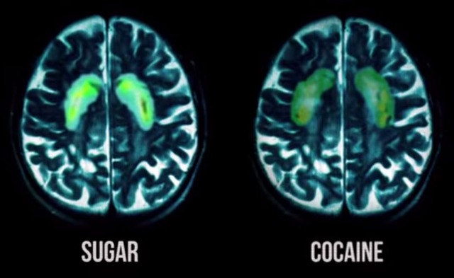 
Liệu đường có gây nghiện như ma túy?

