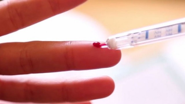  Một xét nghiệm HIV ngày nay có thể thực hiện trong 15 phút, liệu điều tương tự có thể được thực hiện với vi khuẩn? 