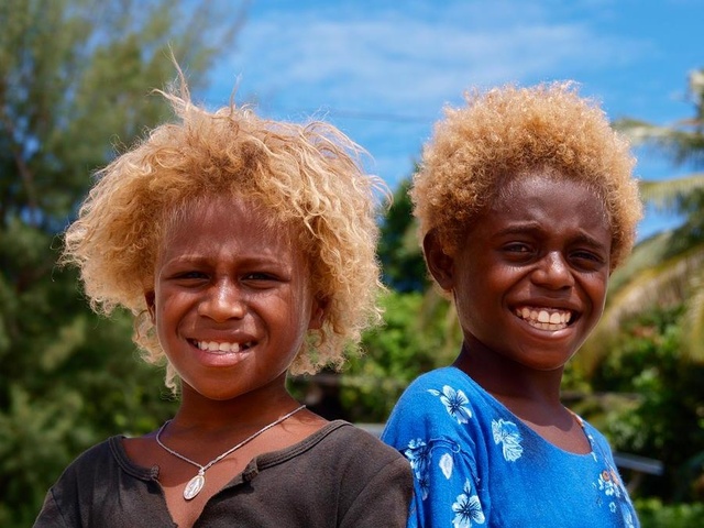  Hai cậu bé tóc vàng bẩm sinh tới từ vùng Melanesia. 