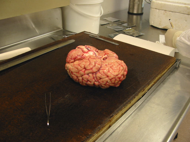  Một bộ não được đặt ngược, đang chờ giải phẫu. Bộ não con người nặng trung bình khoảng 1.400g, bộ não bình thường nặng khoảng 900 - 2.000g. Các bệnh như Alhzeimer và Huntington làm giảm đáng kể kích thước và trọng lượng não. 