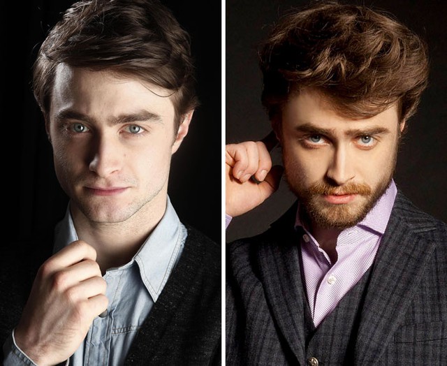  Dù hơi già dặn một chút nhưng diễn viên chính phim Harry Potter trông chất lượng hơn nhiều khi để râu 