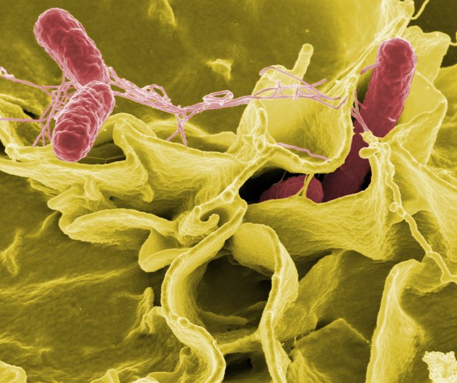  Chẩn đoán Salmonella hiên nay có thể mất tới 3 đến 5 ngày 