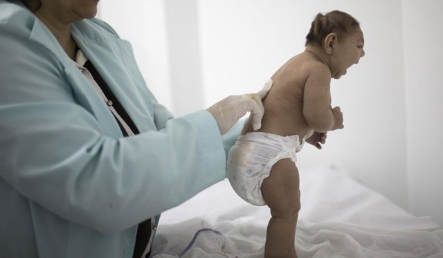  Những đứa trẻ nằm trong bụng người mẹ nhiễm Zika sẽ sớm được bảo vệ 