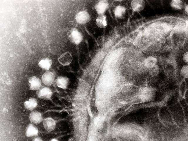  Hình ảnh chụp từ một kính hiển vi điện tử, khi các thể thực khuẩn tấn công một vi khuẩn 