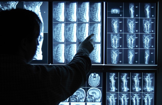  Trí tuệ nhân tạo có khiến các bác sĩ chẩn đoán hình ảnh mất việc làm? 
