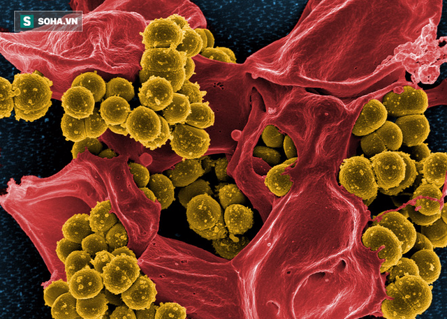  Mỗi năm có hàng triệu cái chết gây ra bởi vi khuẩn kháng kháng sinh 