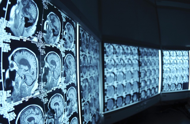  Đột phá số thức đã mở đường cho trí thông minh nhân tạo đi vào lĩnh vực y tế 