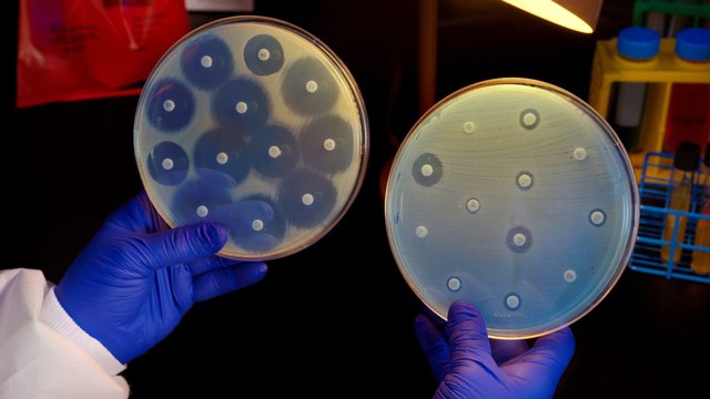  Trong đĩa bên phải, các vi khuẩn nhóm CRE được đặt trong môi trường kháng sinh nhưng vẫn lây lan và phát triển 