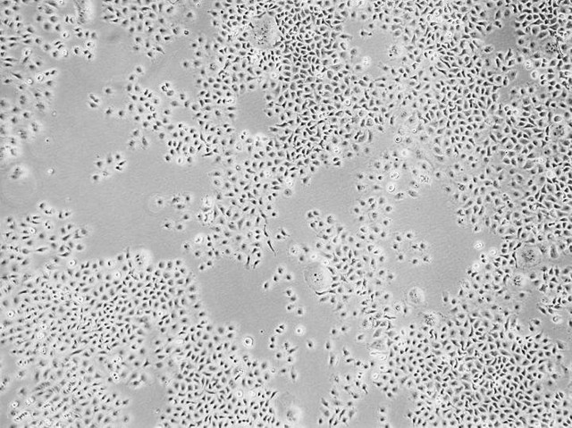  Đây là quần thể các tế bào miễn nhiễm với virus HIV mà các nhà khoa học tạo ra 