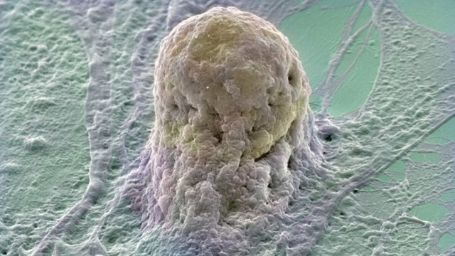 
Ảnh chụp một tế bào gốc của con người
