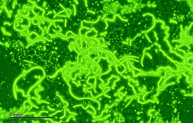  Vi khuẩn lam - Loài sinh vật này có thể nhỏ bé, nhưng những dấu ấn chúng đã lưu lại trong lịch sử của trái đất thì không hề nhỏ​ 