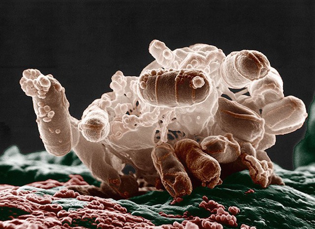  Vi khuẩn E. coli nhìn dưới kính hiển vi điện tử 