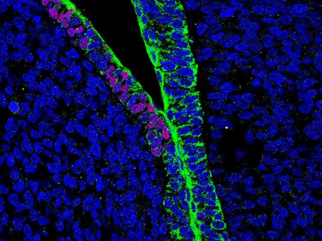  Các tế bào người màu xanh lá cây trong phôi thai chimera 