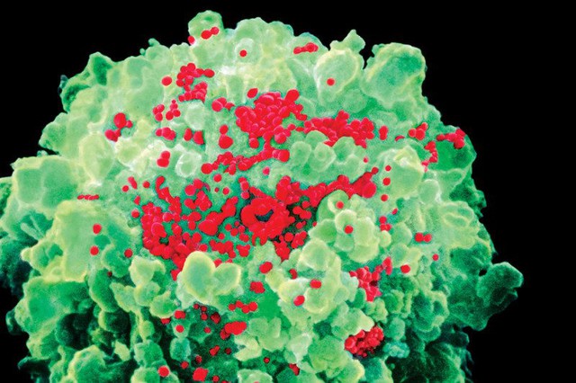  Các virus HIV phát triển lại trong một tế bào khi bệnh nhân ngừng dùng thuốc ARV 