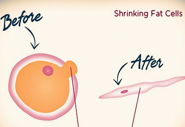  Nếu bạn giảm cân, đó là do các tế bào mỡ đã co lại 