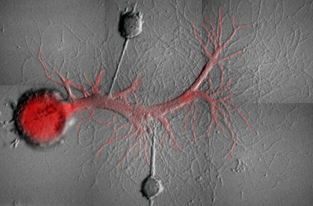  Các neuron thần kinh của sên 