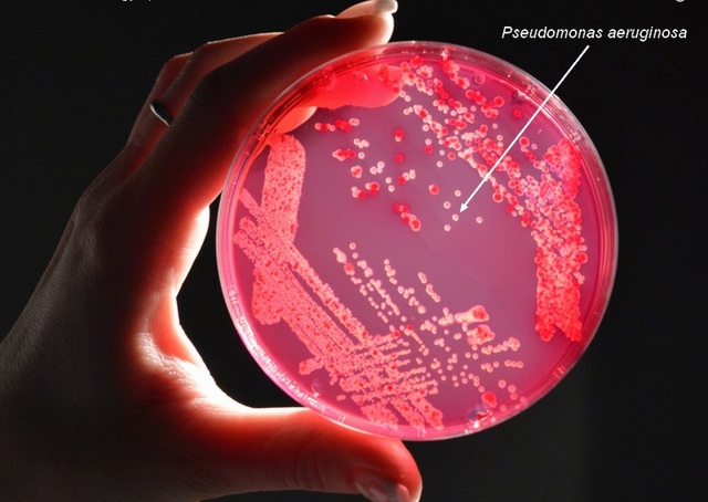  Trực khuẩn mủ xanh (Pseudomonas aeruginosa) là một loại vi khuẩn đa kháng thuốc đáng lo ngại 
