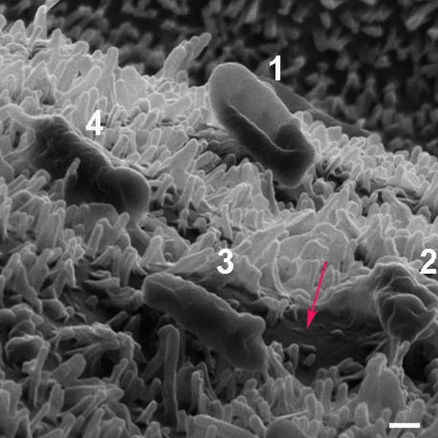  4 trạng thái của vi khuẩn trên bàn đinh, từ sống bình thường tới chết và xẹp lép 