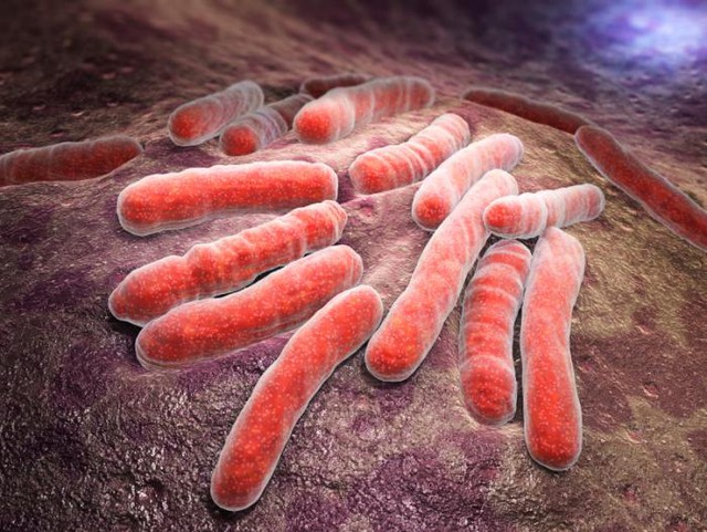  Một chủng vi khuẩn lao kháng kháng sinh nguy hiểm đang lây lan dễ dàng hơn 