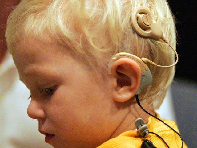  Những đứa trẻ khiếm thính thường được cấy chép ốc tai điện tử, dưới sự quyết định của cha mẹ 