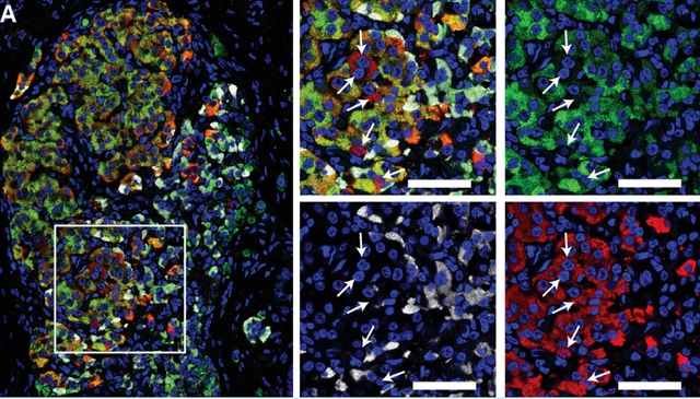  Các nhà khoa học phát hiện ra một loại tế bào mới ở tụy, đó là hi vọng cho bệnh nhân tiểu đường 