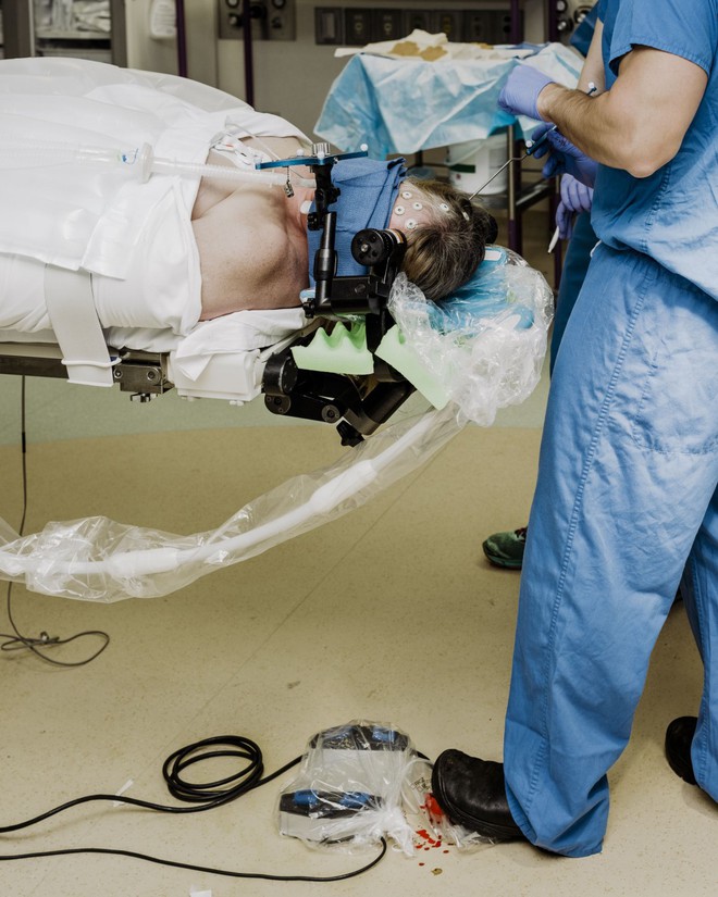 Một trong những bệnh nhân u não của Leuthardt đang được gây mê trong ca phẫu thuật bằng laser xâm lấn tối thiểu 