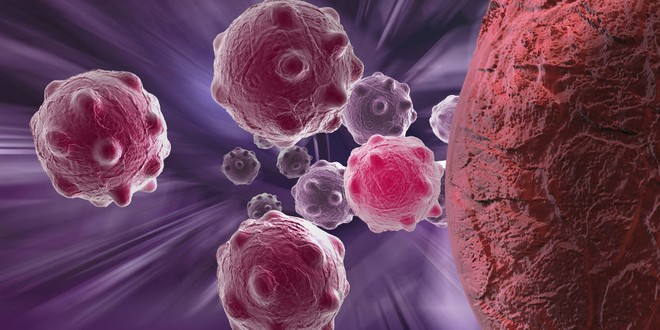  Các nhà khoa học Mỹ tìm ra con đường ngăn chặn ung thư di căn 
