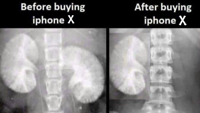  Trước khi mua iPhone X và sau khi mua iPhone X. 