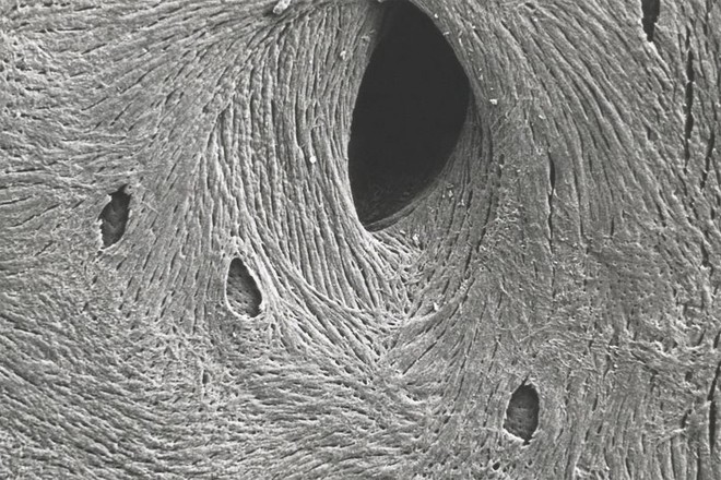  Bề mặt của xương khi nhìn dưới một kính hiển vi 
