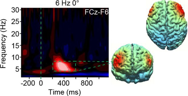  Kết qủa thử nghiệm cho thấy sự hoạt động của não bộ gia tăng sau khi được kích thích HD-tACS 