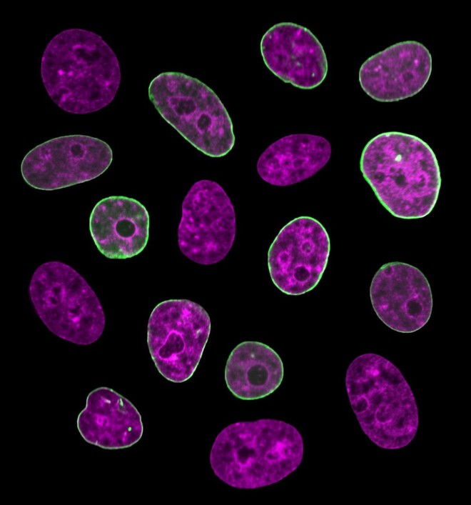  Các tế bào sống dưới kính hiển vi huỳnh quang 