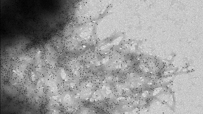  Ảnh chụp những vị trí khuẩn lạc hình thành trên màng (màu đen) dưới kính hiển vi 