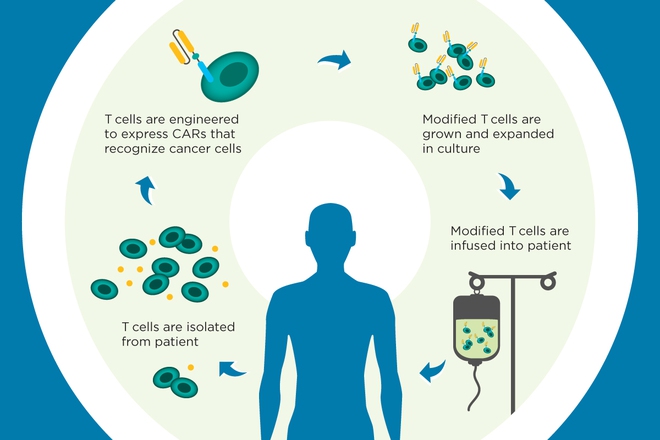 
Mô tả quá trình điều trị ung thư bằng liệu pháp miễn dịch CAR-T
