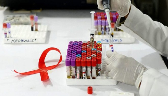 
Tìm ra kháng thể giết được 99% chủng virus HIV, hy vọng lớn cho những người bị HIV
