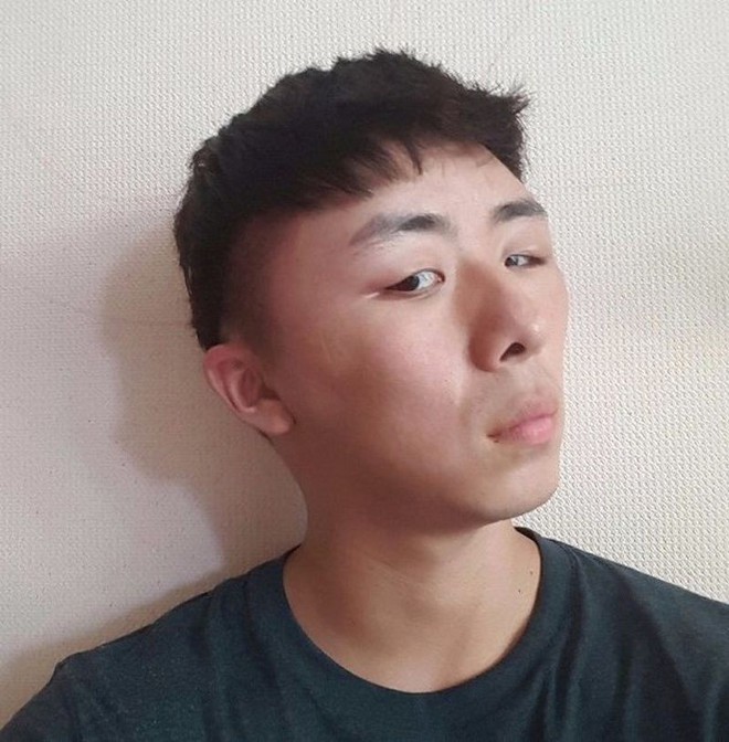 Chết cười với anh chàng Hàn Quốc bị dị ứng thuốc nhuộm tóc, đầu sưng to như quả bóng bay - Ảnh 12.