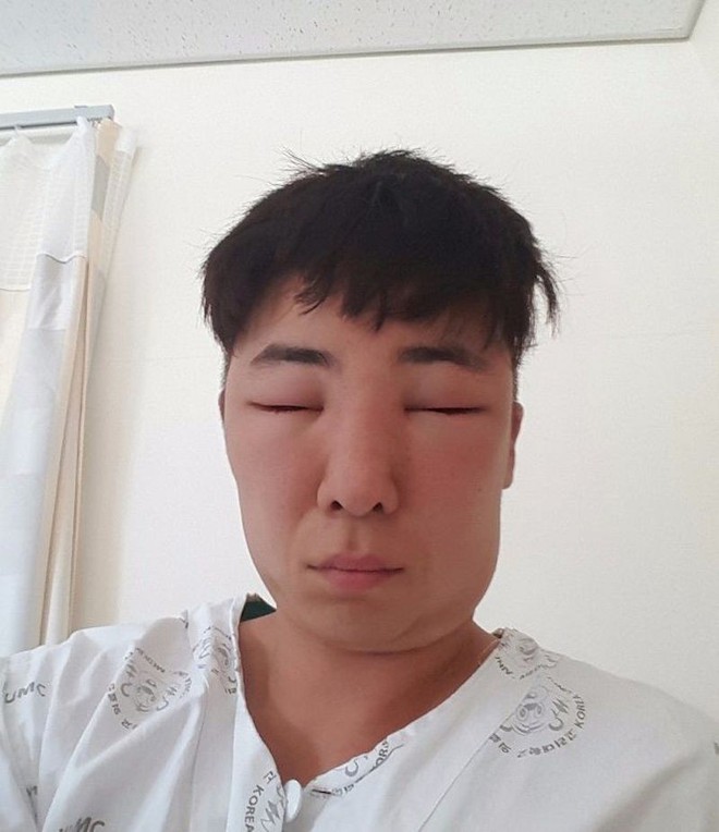 Hí hửng đi nhuộm tóc, anh chàng Hàn Quốc nhận về quả đầu phình như nhân vật hoạt hình - Ảnh 16.