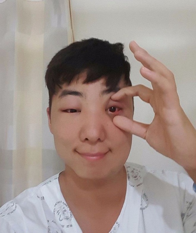 Hí hửng đi nhuộm tóc, anh chàng Hàn Quốc nhận về quả đầu phình như nhân vật hoạt hình - Ảnh 17.