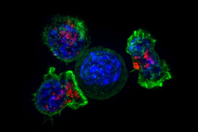 Các tế bào T vờn quanh một tế bào ung thư trước khi tiêu diệt nó 
