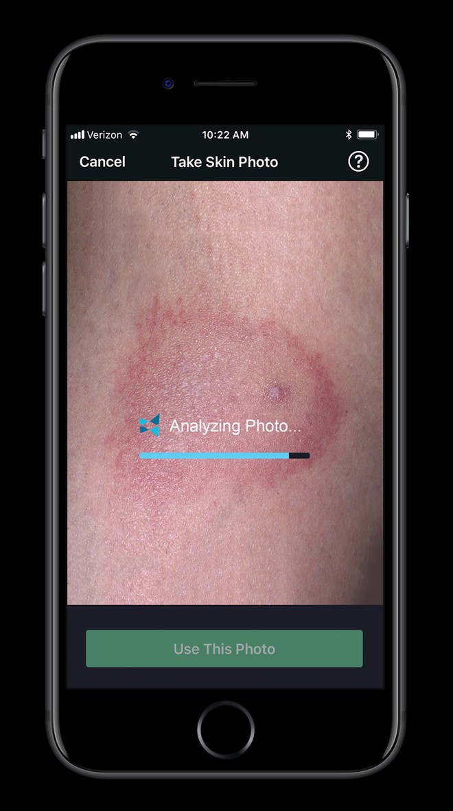 Apple cho ra đời ứng dụng giá 100 USD phát hiện bệnh da liễu thông qua ảnh chụp - Ảnh 5.