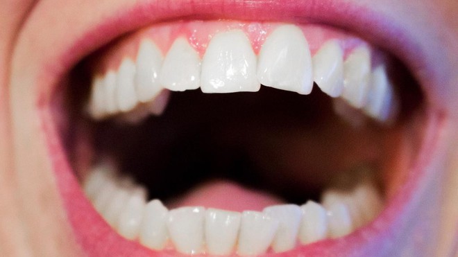  Điều gì sẽ xảy ra khi những vết sâu răng, vỡ răng có thể tự động lành lại? 
