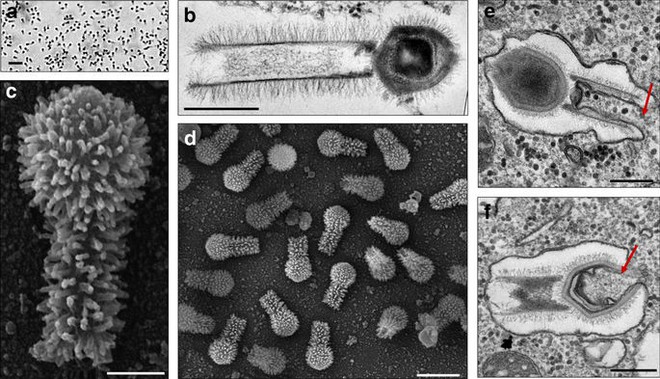  Hình ảnh phóng đại ở các kích thước khác nhau của Tupanvirus 