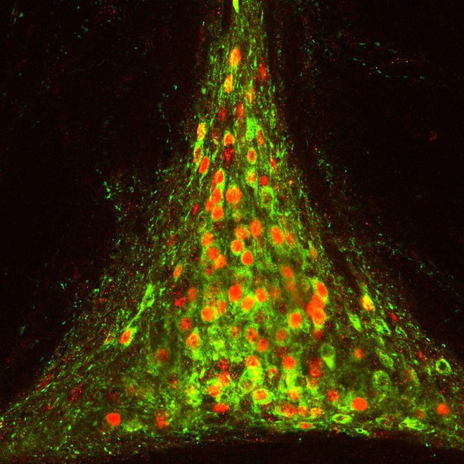  Vệt các nơ-ron thần kinh (màu đỏ) trong não phản ứng với cơn khát 