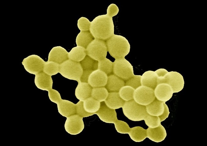 Gà đẻ trứng vàng chỉ có trong cổ tích, còn loại vi khuẩn đẻ ra vàng này là có thật - Ảnh 1.